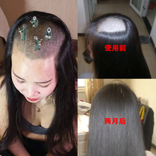 头发自然生长快速 头发变密变多变长 生发液 钱不要 不长