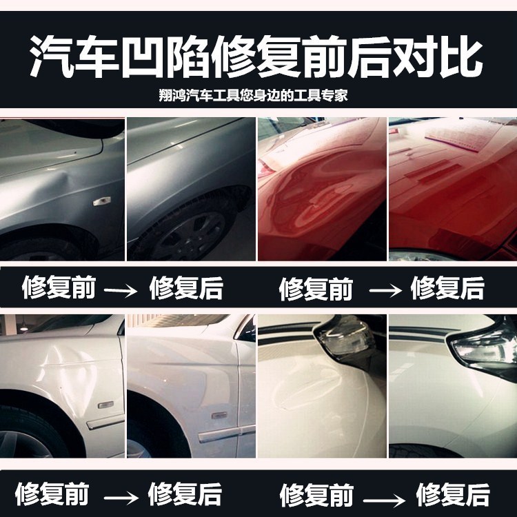凹陷修复价格