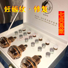 送按摩仪孕尔美妊娠纹修复孕婴美妊娠纹妊娠纹孕无纹妊娠纹
