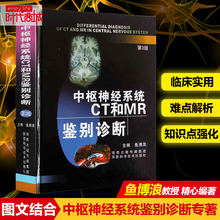 正版现货 中枢神经系统CT和MR鉴别诊断 第3版 鱼博浪教授 著 影像医学内科学 神经系统诊断 神经系统疾病颅影像疾病颅脑核磁共振