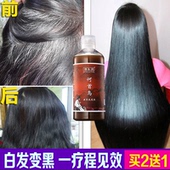 德生源何首乌治白发变转黑发洗发水少白头中老年纯植物无硅油正品