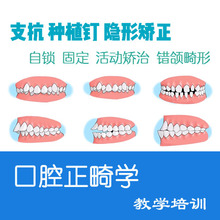 口腔电子书 正畸学 教学视频 隐形矫正 微支抗种植钉培训 书籍