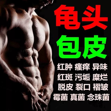治疗龟头炎阴茎痒红肿包皮垢炎症珍珠疹脱皮瘙痒异味男士消炎药膏