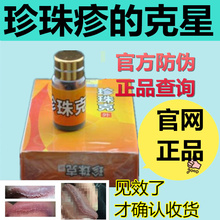 去除珍珠疹冠状沟处送6礼 珍珠疹男软膏洗液私处珍珠克官方正品