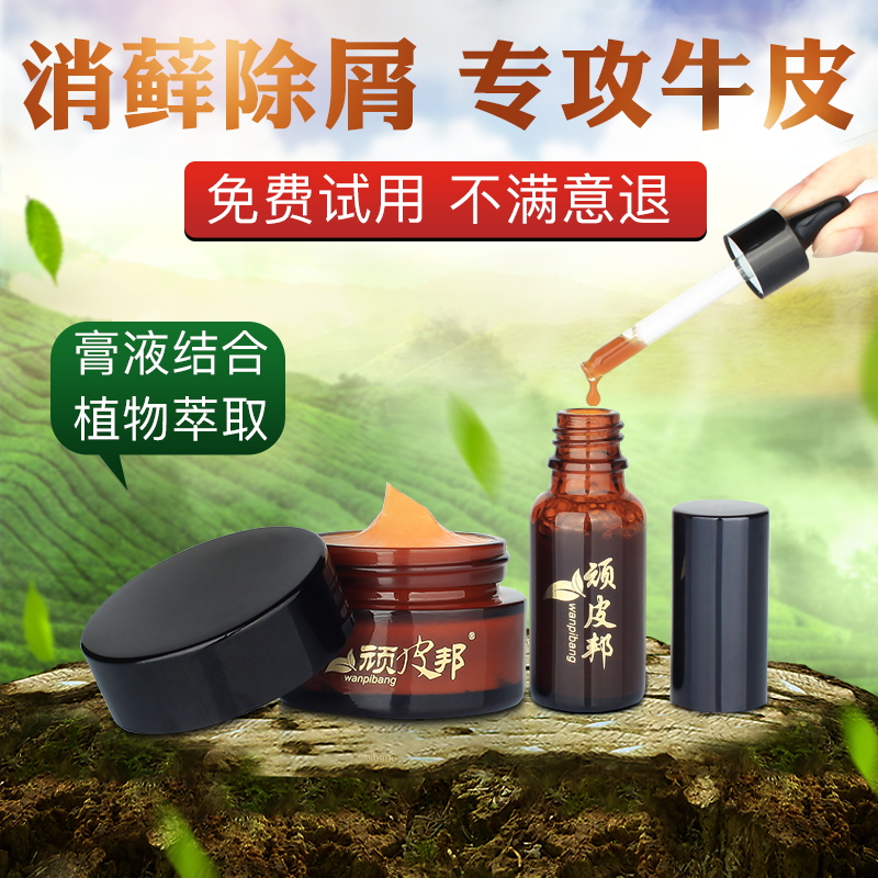 银屑癣外用头部皮肤专用胶囊颗粒专治藓净软膏