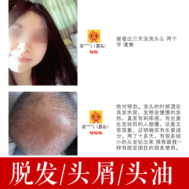 生姜精油老姜身体揉按油祛湿泡脚生发单方暖宫经痛刮痧全身正品热 生姜精油老姜身体揉按油祛湿泡脚生发单方暖宫经痛刮痧全身正品热
