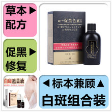 白癜風外用药黑色素促生长修复软膏白斑遮盖液霜克星肤色持久防水