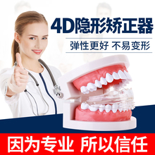 成人 隐形牙套矫正龅牙牙齿不整齐保持器磨牙套 4D成人牙齿矫正器