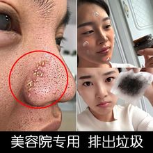 排毒膏面部排毒清洁毛孔补水保湿美白淡斑祛痘脸部深层清洁脸部