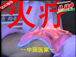 火疗法藏药偱经火疗特色医疗新技术视频操作600M