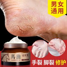 手足裂口脚后跟干裂脚跟皲裂防裂龟裂膏开裂马油护手愈霜足部护理