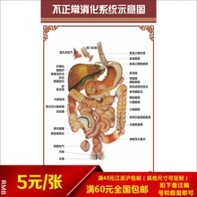 医院科室人体解剖装 饰展板挂图挂画病变不正常肠胃肝胆消化系统