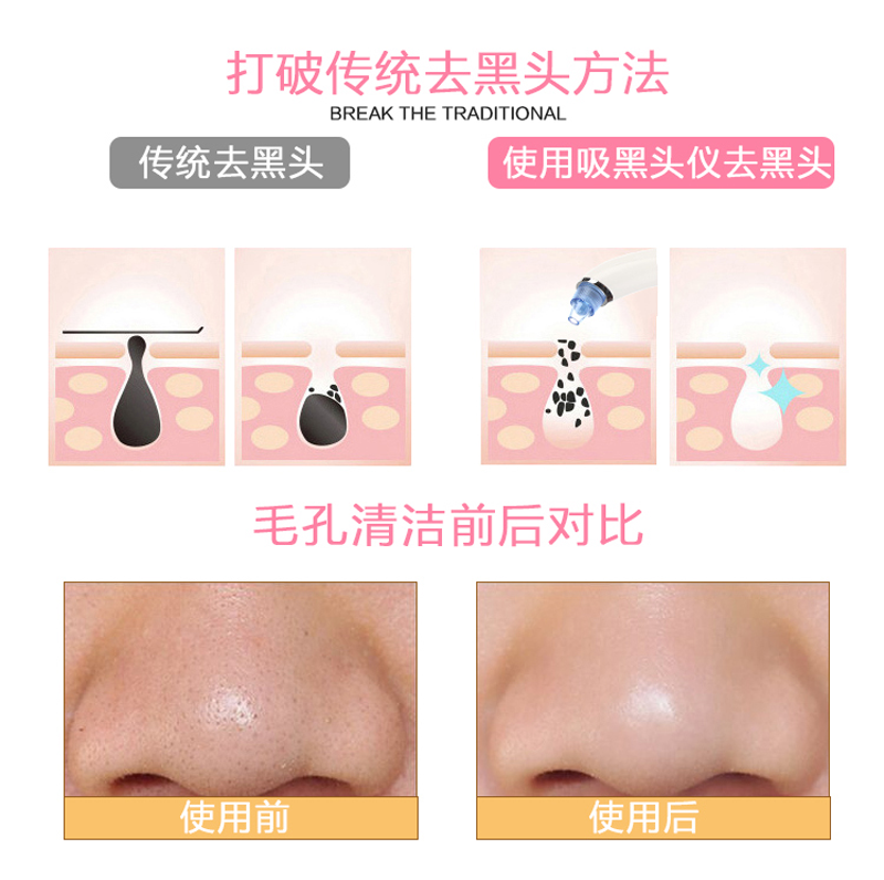 keonbaso/��������ȥ��ͷ�۴���KBS-13142