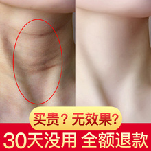 颈纹小熨斗 告别暗黄颈纹 六胜肽美颈霜 还你天鹅颈