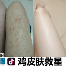 【机皮肤救星】2018新款从此告别机皮肤 买2送1【抖音同款】