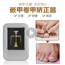 卷甲矫正器甲沟嵌炎甲提拉器鹰嘴钳剔甲器脚趾甲拉拉贴美甲工具