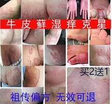 治牛皮銀屑无激素癬手脚屁股成人皮肤瘙痒止痒膏溼痒抑菌外用藓药