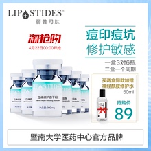 收毛孔 丽普司肽egf冻干粉寡肽原液修复因子去淡化祛痘印痘坑正品