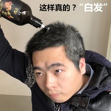 白发克星 买2送1 白发变黑发转黑乌发洗发水 小红书超火