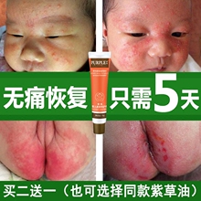紫娃婴儿紫草特护膏宝宝淹红脖子屁屁股止痒护臀膏口水疹无激素霜
