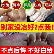 脚气膏止痒脱皮烂脚杀菌正品 成人去除臭汗脚臭克星水泡型灵