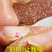 买一送三 去脏脸神器 第二件半价 2018抖音同款 美丽更自信
