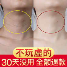 暴露年龄 六胜肽美颈霜颈纹霜 不只是脸 让您拥有天鹅颈