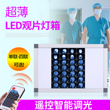 医用观片灯LED观片灯箱x光阅片灯单联双联三联骨科看片灯观片灯箱