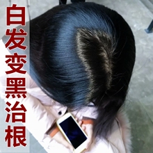 白发变黑发头发变黑治根转黑神器少年白发纯植物洗发水乌发液正品