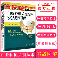版临床用书彩图版 现货正版口腔种植关键技术实战图解人卫版供口腔医师研究生进修生用书口腔种植医学书籍医师临床用书彩印精装