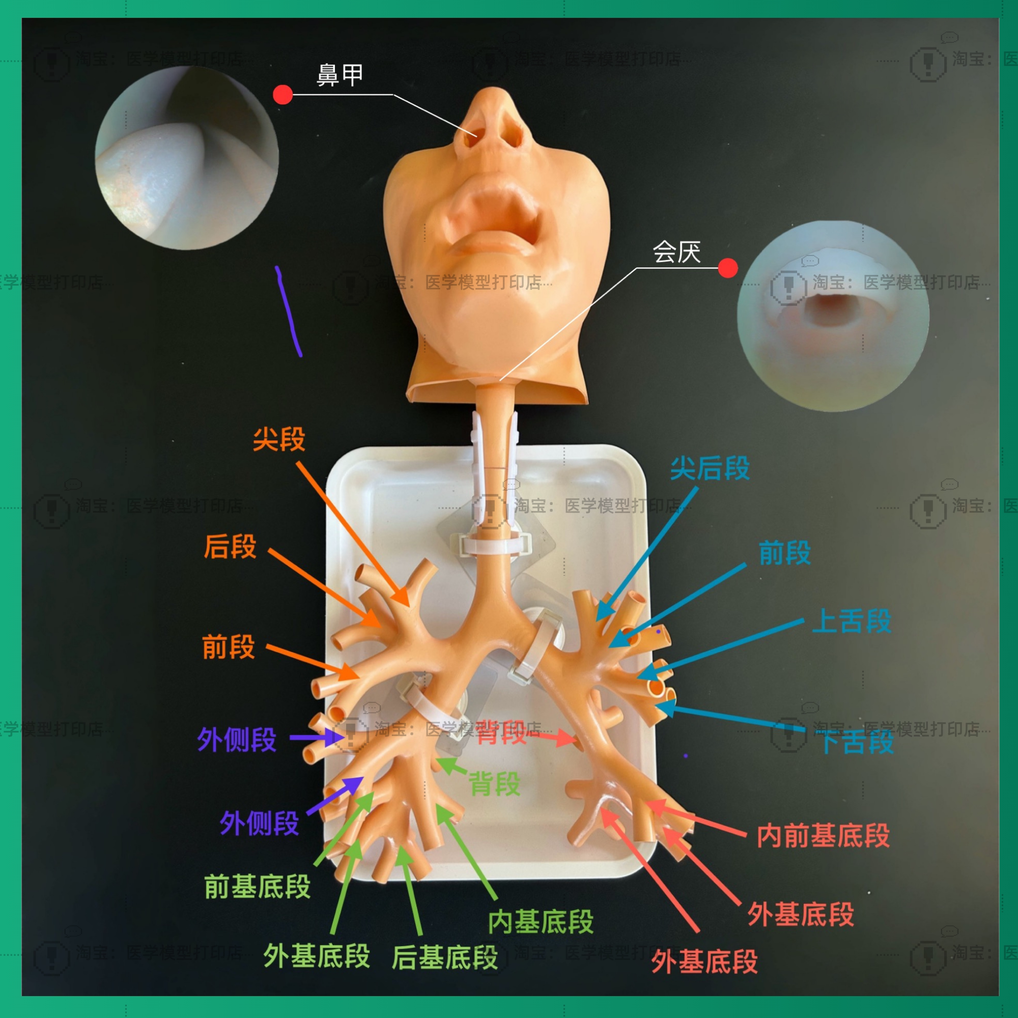 支气管镜哪些品牌好气管镜品牌哪个好？训练用模型怎么选才靠谱？_https://www.jmylbn.com_新闻资讯_第6张
