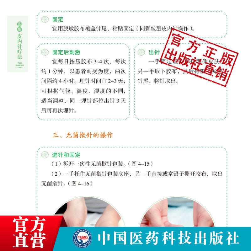 学会皮内针疗法,轻松应对日常小毛病 - 好物爆料 - 淘江湖