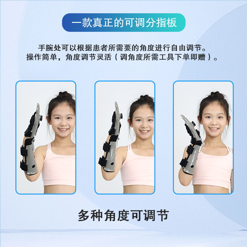 什么是分指板分指板器是什么？康复训练中不可忽视的手部支撑工具 🌟_https://www.jmylbn.com_新闻资讯_第2张