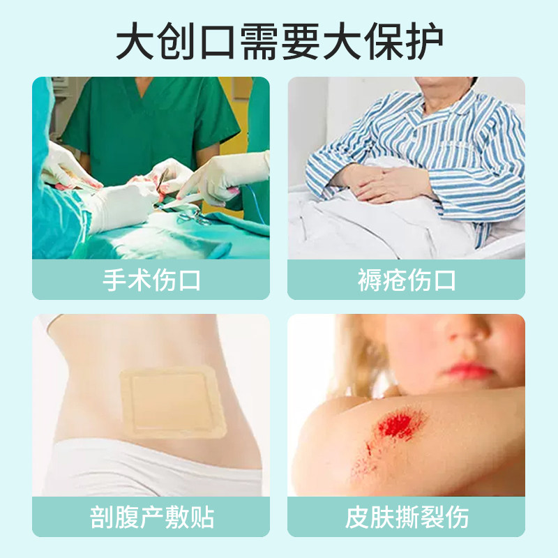 硅凝胶敷料怎么用长期卧床老人贴什么敷料能真正缓解压红？答案藏在这类硅凝胶泡沫里 🌟_https://www.jmylbn.com_新闻资讯_第5张