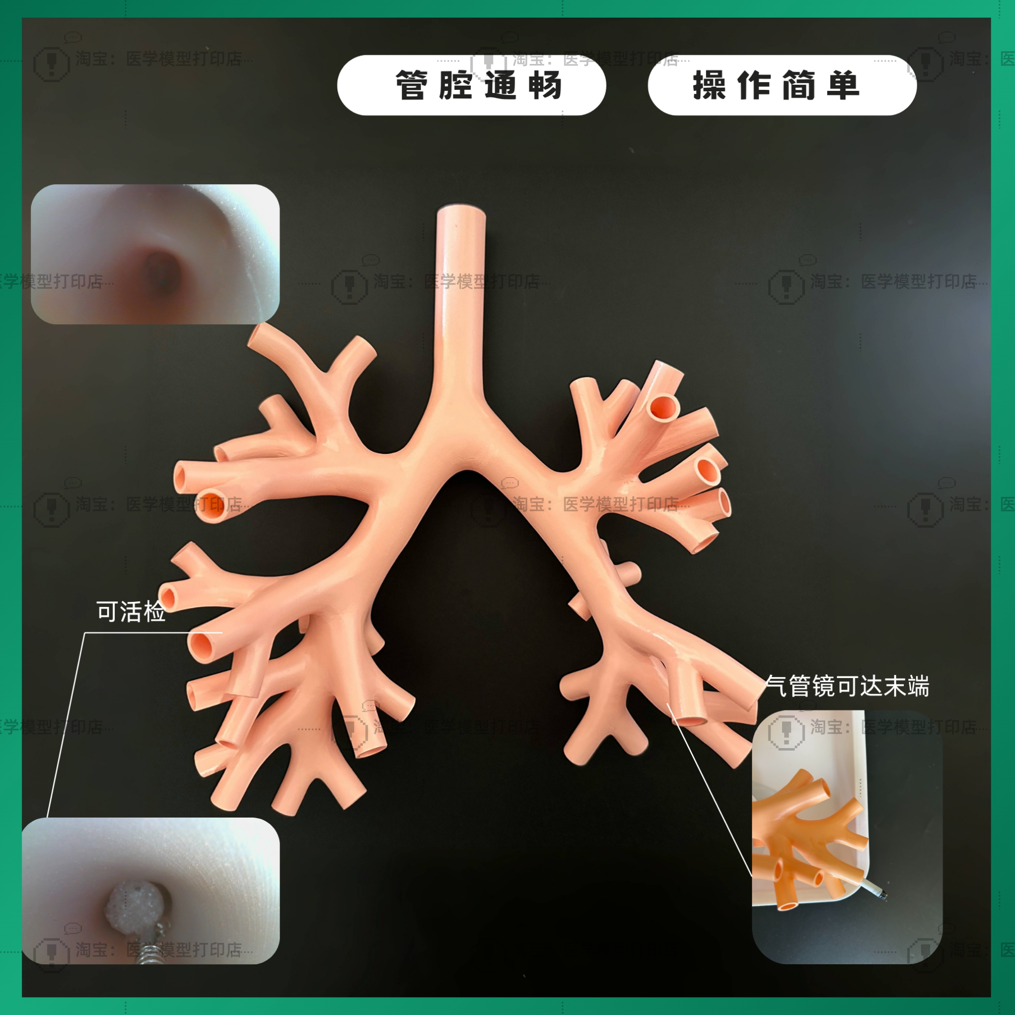 支气管镜哪些品牌好气管镜品牌哪个好？训练用模型怎么选才靠谱？_https://www.jmylbn.com_新闻资讯_第4张
