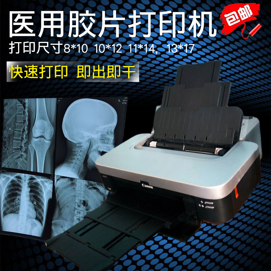 医用喷墨胶片机真可颠覆放射科。此波国货太敢想了！