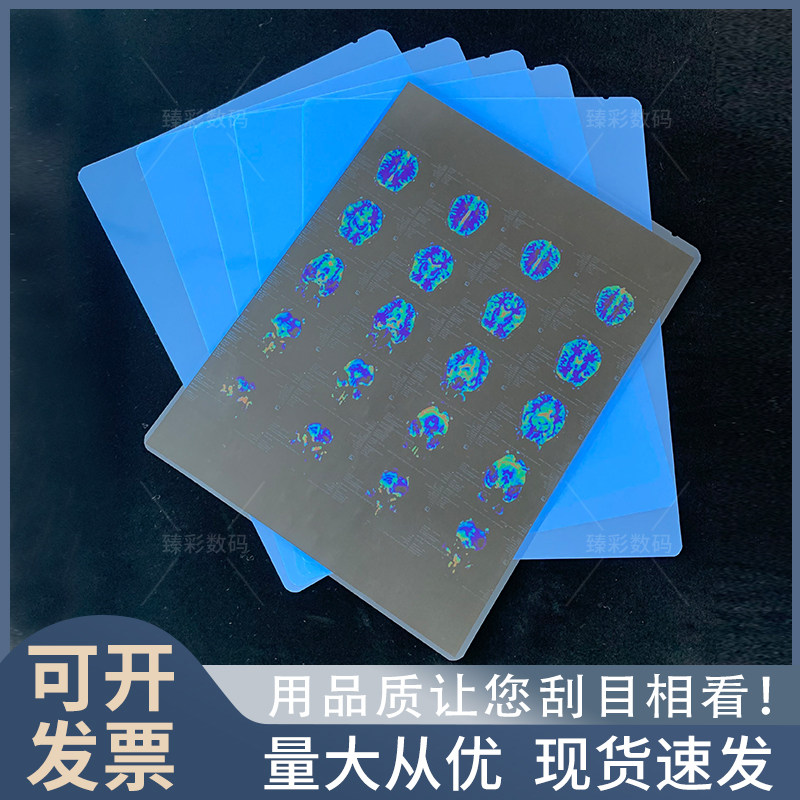 c型臂什么牌子好C型臂哪个品牌好？主流医用影像设备解析_https://www.jmylbn.com_新闻资讯_第4张