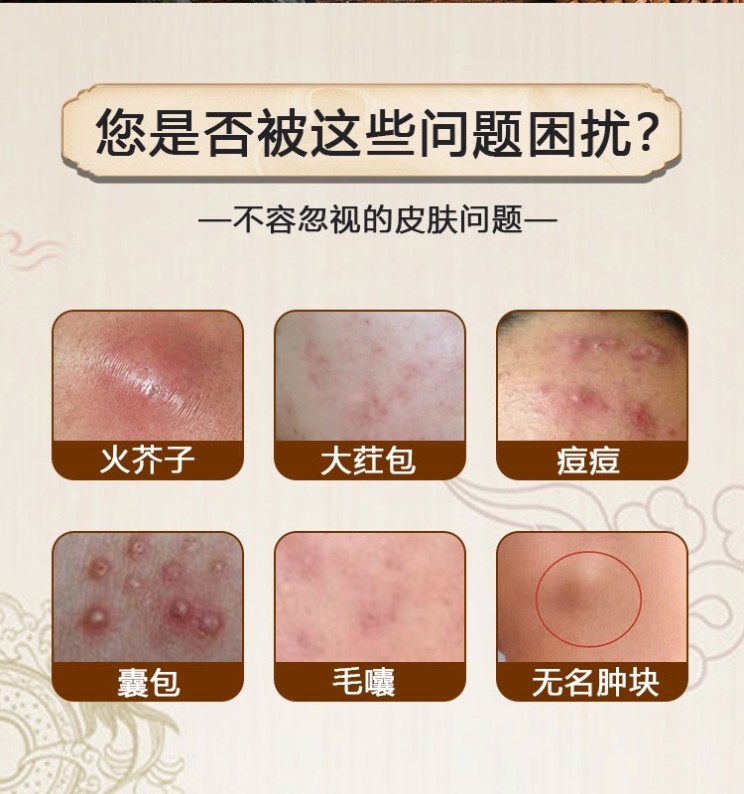 火疖子闷头不破怎么办?羊毛盯町拔毒膏贴这样用才对症💡 - 好物爆料 - 淘江湖